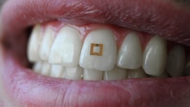 تطور تكنولوجي جديد .. شريحة بحجم 2 ملم لتطوير مُستشعر يُثبّت على الأسنان
